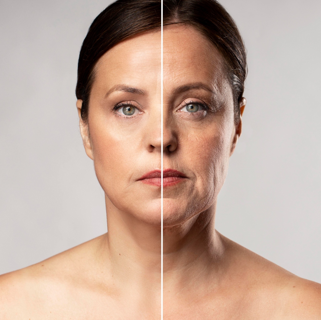 Sculptra e Elleva Bioestimuladores
